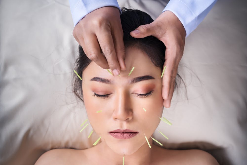 treatment,medical,cosmetician,woman,beauty,skincare,young,forehead,skin,cure,acupuncturist,healthcare,professional,head,beautiful,holding,japanese,patient,wellbeing,cosmetic,female,facial,hand,lying,pain,spa,therapy,relaxation,alternative,asian,health,medicine,thai,procedure,korean,people,stimulate,acupuncture,close-up,face,closeup,person,clinic,detail,needle,care adult female person woman head face massage cosmetics lipstick
